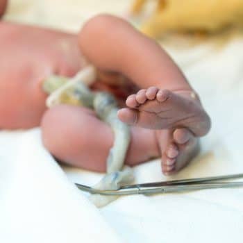 newborn baby umbilical cord blood