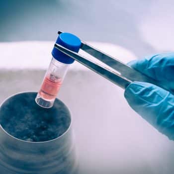 Stem Cell bottle kept frozen