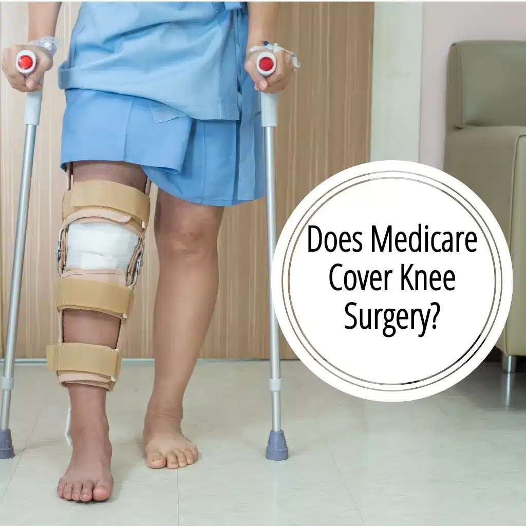 Does Medicare Cover Knee Replacement Surgery? - EZ.Insure